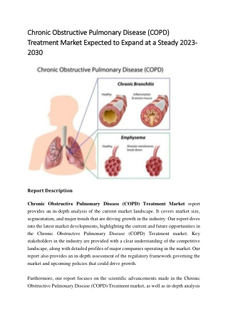 Chronic Obstructive Pulmonary Disease (COPD) Treatment Market to See Huge Growth