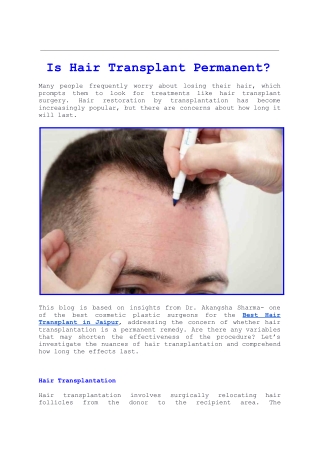 Is Hair Transplant Permanent?