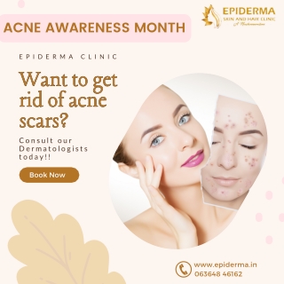 Get rid of acne scars | Epiderma Skin and Hair Clinic Jayanagar, Bangalore