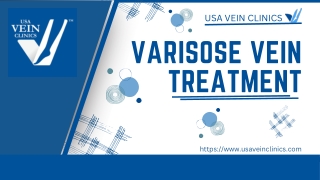 VARICOSE VEIN TREATMENT