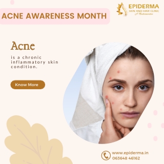 What is known as Acne | Skin Clinic in Jayanagar | Epiderma Skin and Hair Clinic