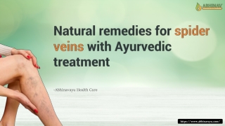 Natural remedies for spider veins with Ayurvedic treatment