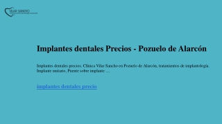 Implantes dentales Precios  Pozuelo de Alarcón