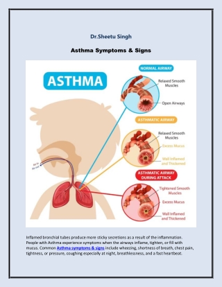 Asthma Symptoms & Signs