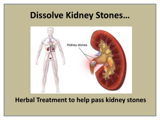 Treating Kidney Stones Naturally with Stonil Capsule
