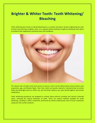 Brighter & Whiter Teeth: Teeth Whitening/ Bleaching
