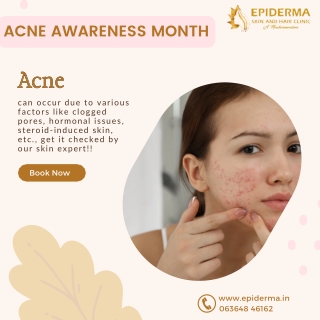 Risk Factors of Acne | Best Skin Clinic in Jayanagar | Epiderma Clinic