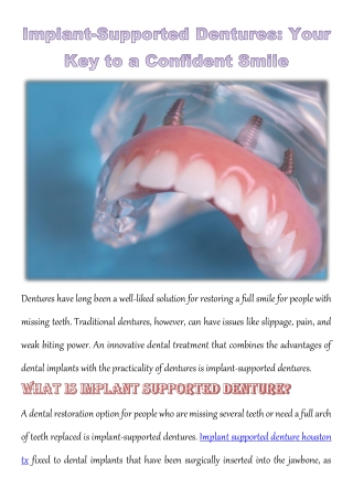 Implant-Supported Dentures: Your Key to a Confident Smile