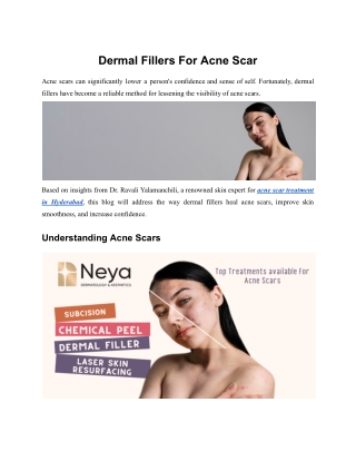 Dermal Fillers For Acne Scar