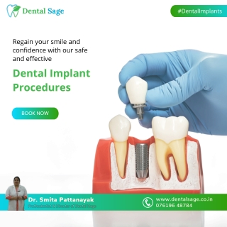 Regain your smile and confidence with Dental Implant | Dental Sage