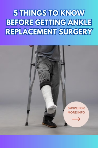 5 Things to Know Before Getting Ankle Replacement Surgery
