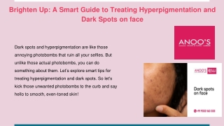Brighten Up_ A Smart Guide to Treating Hyperpigmentation and Dark Spots on face