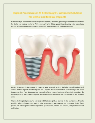 Implant Procedures in St Petersburg FL - Advanced Solutions for Dental and Medical Implants