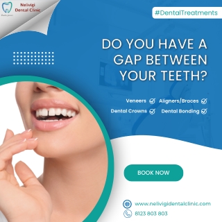 Do you have a gap between your teeth | Nelivigi Dental Clinic