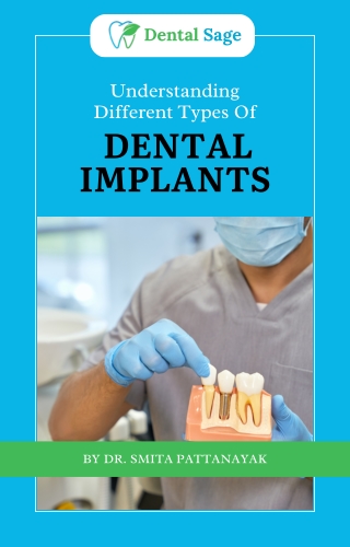 Understanding Different Types Of Dental Implants - Best Dental Clinic in Yelahanka - Dental Sage