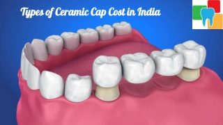 Types of Ceramic Cap Cost in India