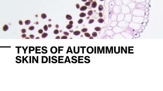 TYPES OF AUTOIMMUNE SKIN DISEASES_