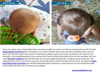 Infant Flat Head Treatment & Infant Cranial Helmet UK