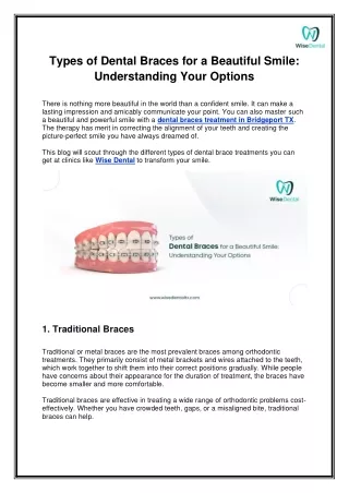 Different Types of Dental Braces Explained