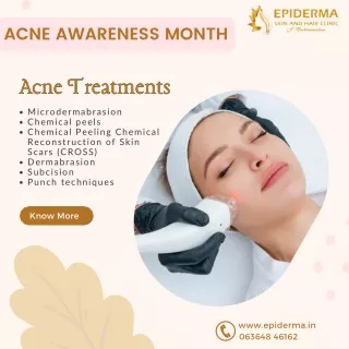 Acne Treatments | Best Skin Clinic in Jayanagar, Bangalore | Epiderma Clinic