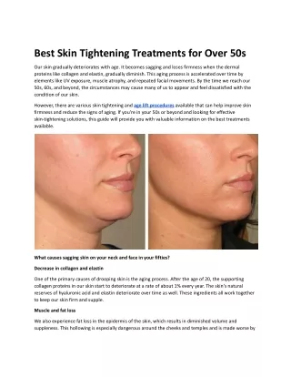 Best Skin Tightening Treatments.docx