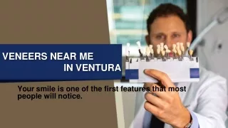 Veneers Dental in Ventura - Channel Islands Family Dental