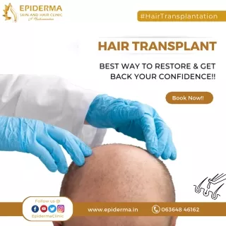 Reliable Hair Restoration Solutions | Hair Clinic in Jayanagar | Epiderma Clinic