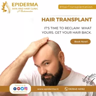 Get your hair back with Hair Transplant | Epiderma Skin and Hair Clinic