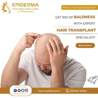 Get Rid of Baldness with Hair Transplantation in Jayanagar | Epiderma Clinic