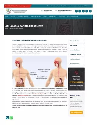 Achalasia Cardia Treatment in PCMC, Pune- Dr. Vikrant Kale