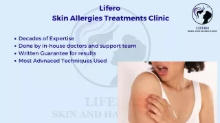 Best Skin Allergies Treatment Near me