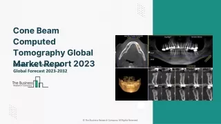 Cone Beam Computed Tomography Global Market Report 2023