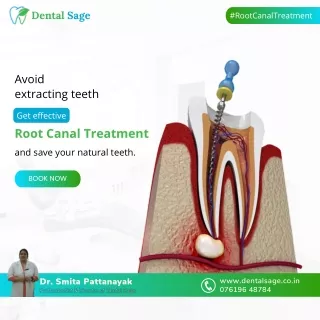 Get effective Root Canal Treatment in Yelahanka, Bangalore | Dental Sage