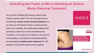 Unlocking the Power of Micro-Needling as Stretch Marks Removal Treatment
