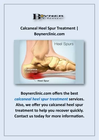 Calcaneal Heel Spur Treatment | Boynerclinic.com