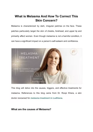 What is Melasma And How To Correct This Skin Concern