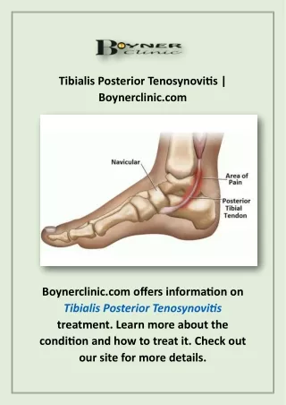 Tibialis Posterior Tenosynovitis | Boynerclinic.com