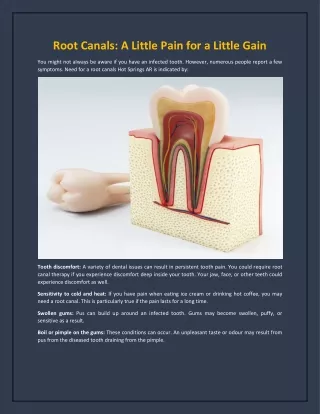Root Canals: A Little Pain for a Little Gain