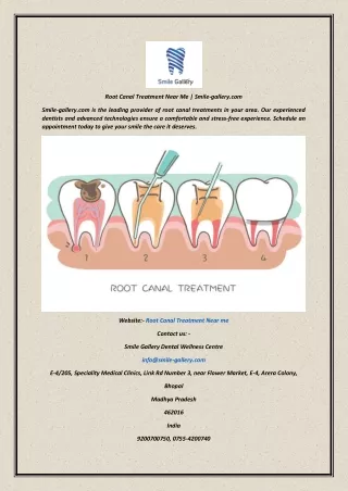 Root Canal Treatment Near Me  Smile-gallery