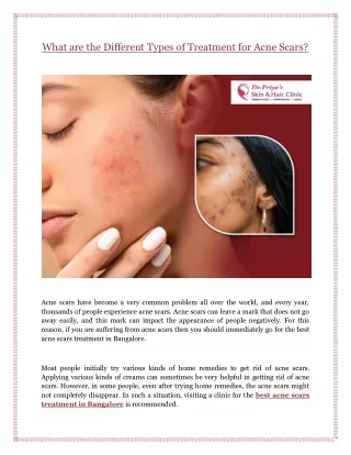 What are the Different Types of Treatment for Acne Scars?