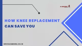 How Knee Replacement Can Save You