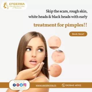 Skip the scars, white heads & black heads | Epiderma Skin and Hair Clinic