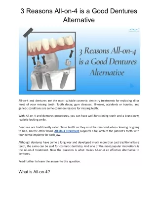 3 Reasons All-on-4 is a Good Dentures Alternative