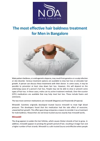 The most effective hair baldness treatment for Men in Bangalore