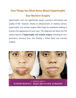 All That You Wanted To Know About Hypertrophic Scar Revision Surgery