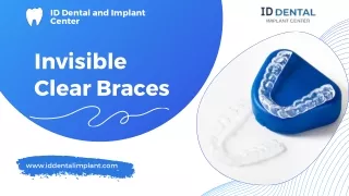 Invisible Clear Braces | ID Dental & Implant Center