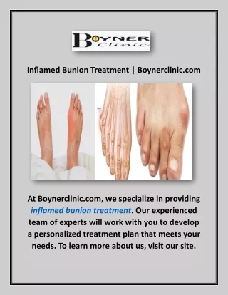 Inflamed Bunion Treatment | Boynerclinic.com