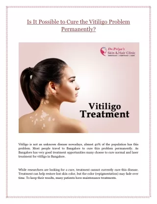 Is It Possible to Cure the Vitiligo Problem Permanently?