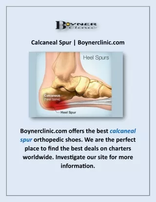 Calcaneal Spur | Boynerclinic.com