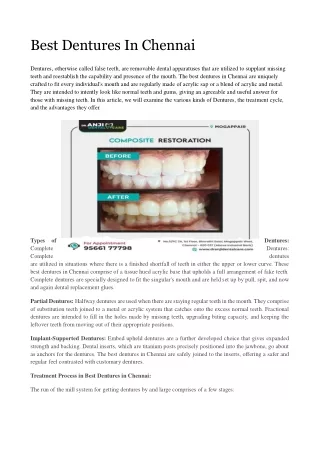 Dentures In Chennai